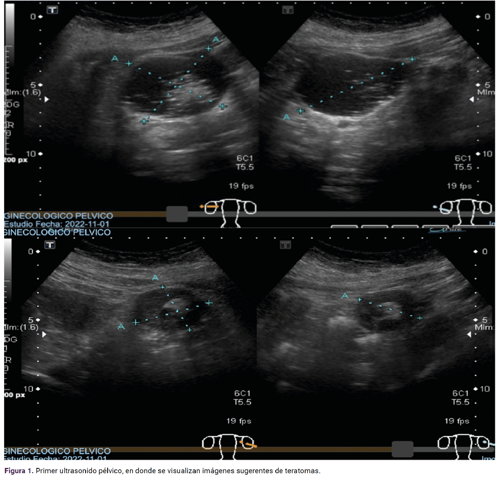 <strong>Figura 1</strong>