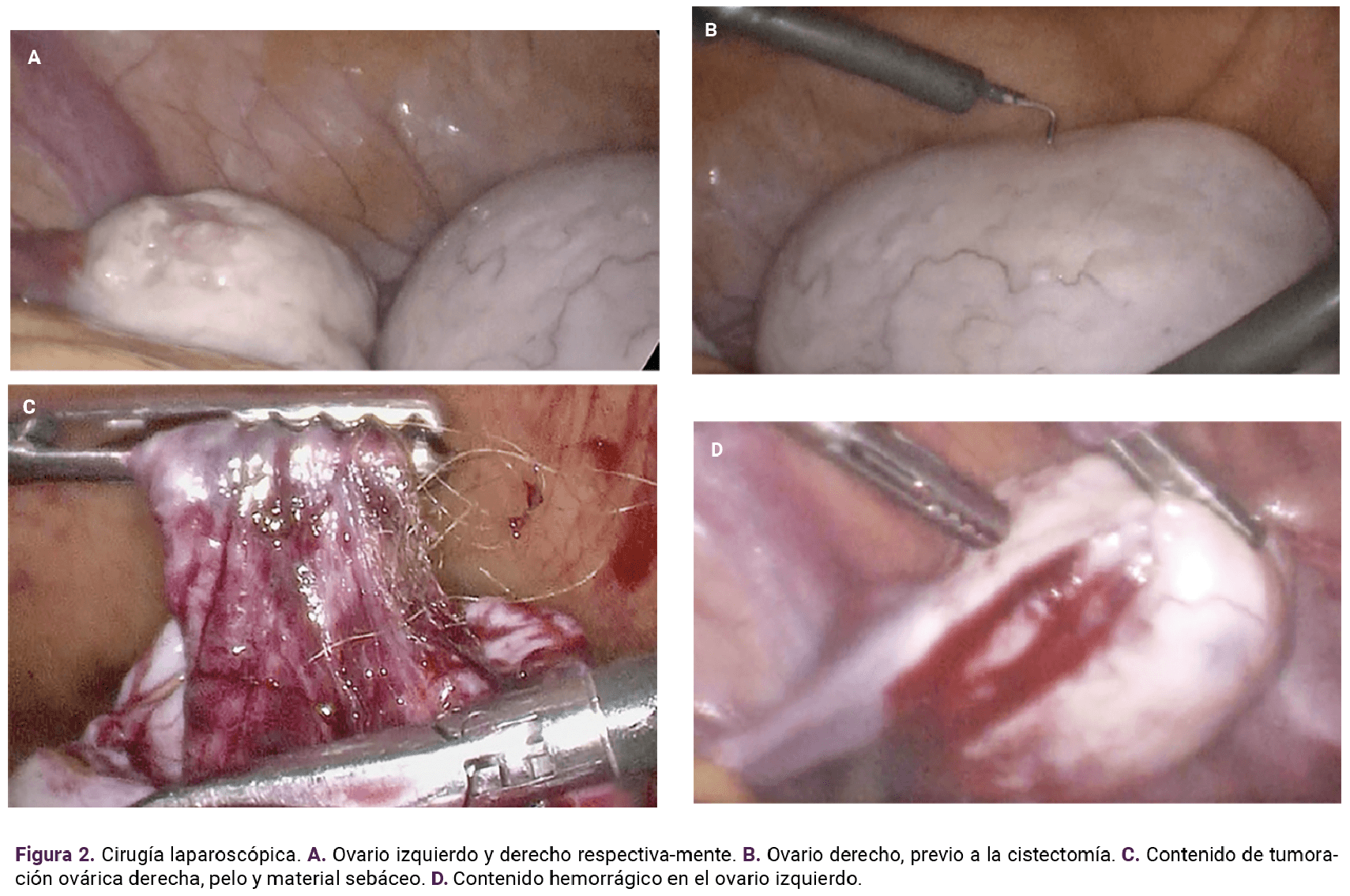 <strong>Figura 2</strong>
