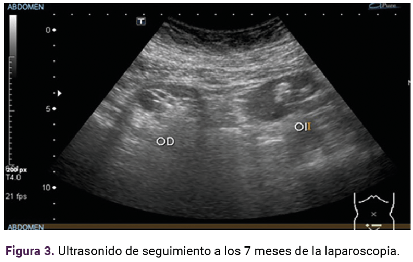 <strong>Figura 3</strong>